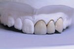 Implantate